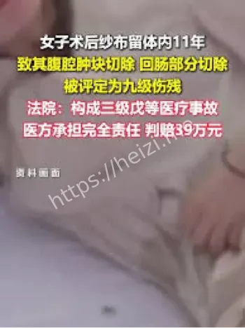手术纱布遗留